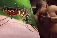 Muž nakazil ženu virem zika během sexu. Jde o první případ v Evropě