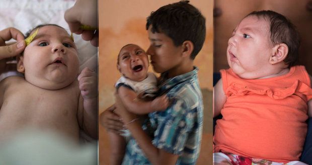 V olympijském Riu řádí nebezpečný virus: Rodí se kvůli němu zdeformovaná miminka