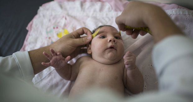 Ministr varuje těhotné Češky před virem zika: Nejezděte do Jižní Ameriky