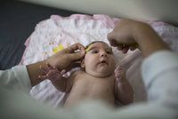 Virus zika je v Německu: Nemocí, která mrzačí děti, se nakazilo 5 lidí