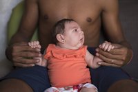 Smrtící virus poškozuje novorozence: Dánsko hlásí první případ zika