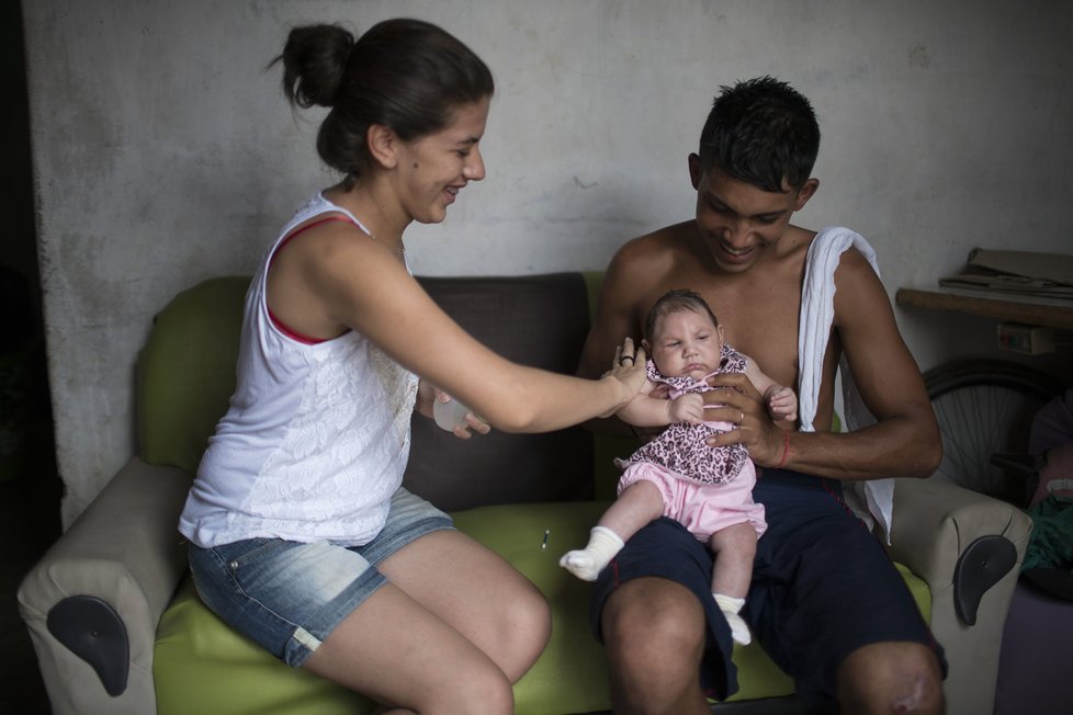 Virus zika způsobuje, že se nakaženým matkám rodí děti s výrazně menší hlavou, což je často zapříčiněno nedostatečně vyvinutým mozkem.