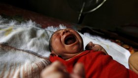 Zika u novorozenců