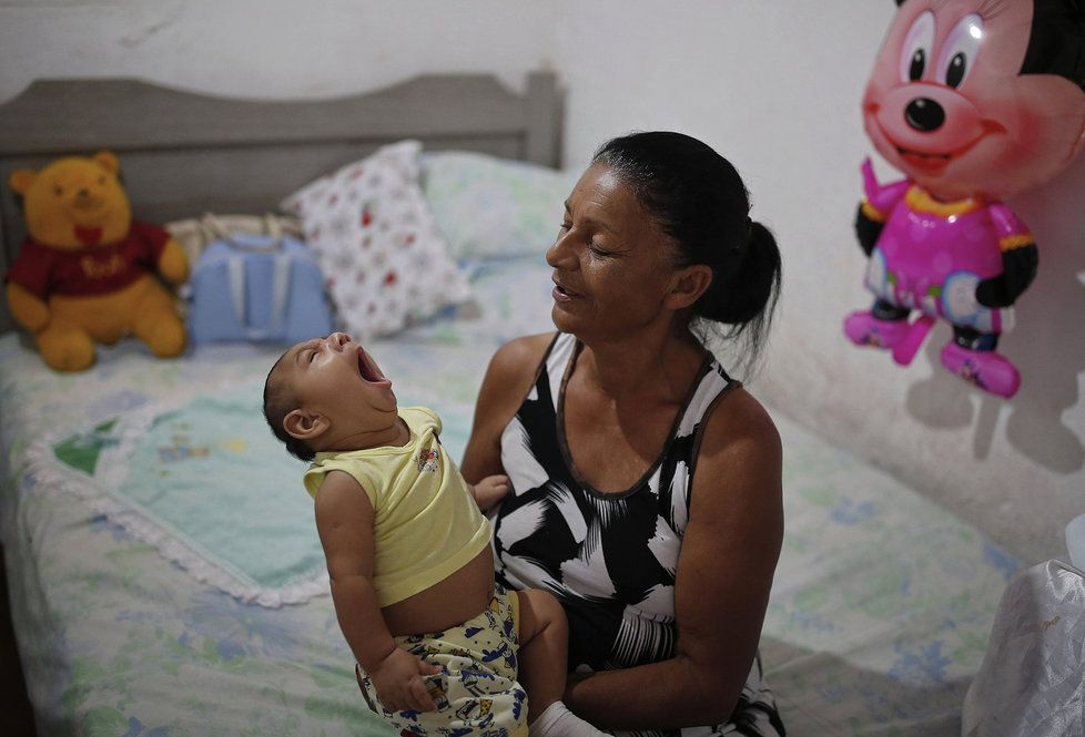 Virus zika způsobuje, že se nakaženým matkám rodí děti s výrazně menší hlavou, což je často zapříčiněno nedostatečně vyvinutým mozkem.