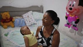 Po viru zika se rodí děti se zdeformovanou hlavičkou