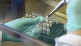 Virus zika má v USA první oběť: Nákazu si do země přivezla
