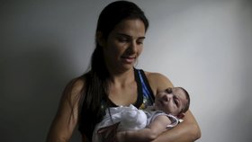 Zika je strašákem pro těhotné. Děti se mohou narodit s vážnou vývojovou poruchou mozku.