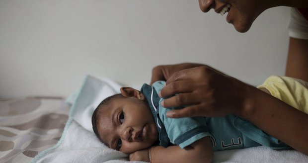 Lékaři: Se zikou je to možná celé jinak. Deformuje dětem hlavy očkování?