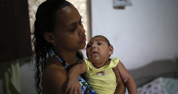 Potvrzeno: Zika vede k mikrocefalii. Je nebezpečnější, než se čekalo