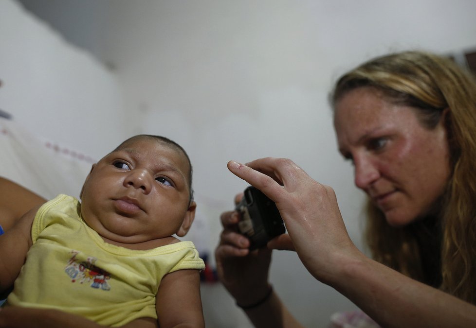 Virus zika způsobuje, že se nakaženým matkám rodí děti s výrazně menší hlavou, což je často zapříčiněno nedostatečně vyvinutým mozkem.