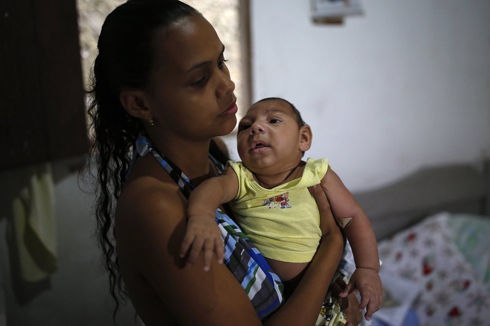 Virus zika zasáhl spoustu dětí