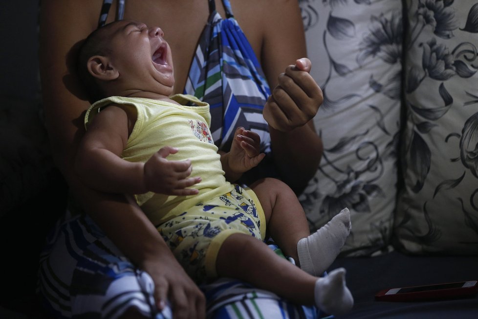 Virus zika poškozuje kmenové buňky, z nichž se při vývoji lidského plodu v těle matky vytváří mozek.