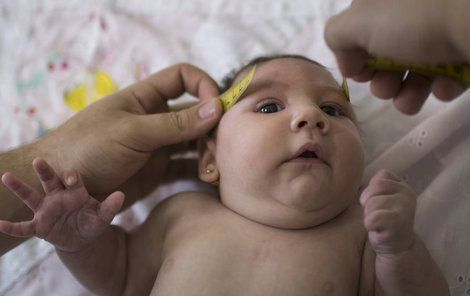 Virus způsobuje, že nakaženým matkám se rodí děti s malou hlavičkou. To způsobuje nedostatečně vyvinutý mozek.