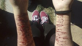 Krvavé drama v Opavě: Pomozte mi se zabít, křičela mladá žena a řezala se