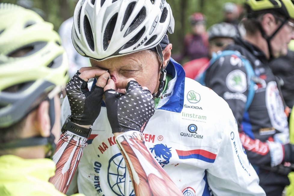 Josef Zimovčák (62), mnohonásobný mistr světa na vysokém kole těžce havaroval hned první den charitativní jízdy Na kole dětem. Nedaleko Aše mu na přejezdu prasklo kolo a sportovec spadl přes řídítka. Navzdory zraněním pokračuje v jízdě z Aše do Znojma, která si klade za cíl vybrat peníze na rehabilitaci onkologicky nemocných dětí.