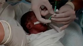 Už po narození bylo jasné, že něco není úplně v pořádku