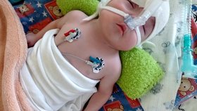 Otakárek nemohl kvůli neprůchodnému nosu ani pořádně dýchat