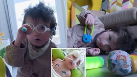 Otakárek se narodil se vzácným CHARGE syndromem