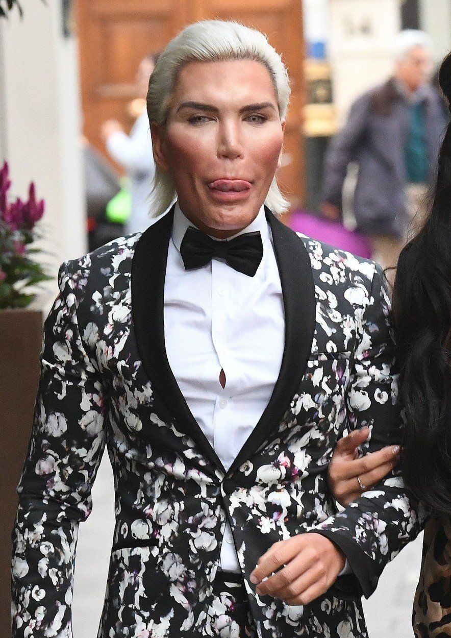 Rodrigo Alves alias živý Ken