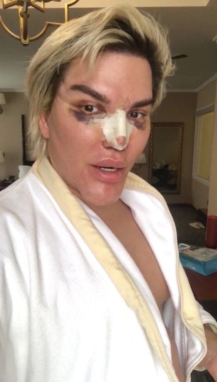 &#34;Živý Ken&#34; Rodrigo Alves