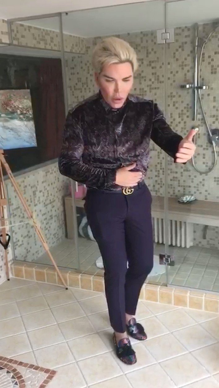 Živý Ken Rodrigo Alves se pochlubil svými posledními zákroky. Do brady si nechal voperovat implantát a nechal si vytvořit &#34;sexy kočičí oči&#34;.