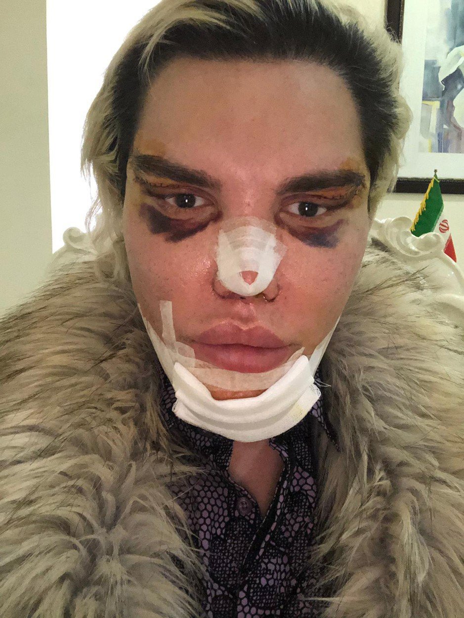 &#34;Živý Ken&#34; Rodrigo Alves