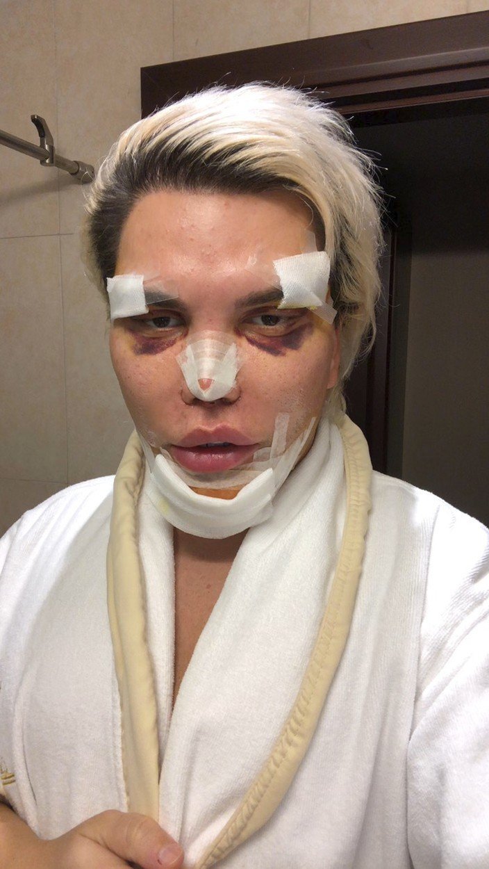 &#34;Živý Ken&#34; Rodrigo Alves