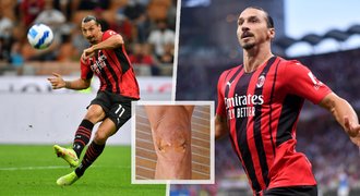 Ibrahimovič ukázal operované koleno! Už zase děsí obrany soupeřů