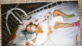 Květen 1998 - Nikolka den po transplantaci.