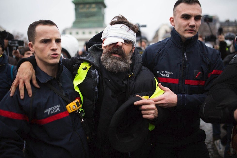 Jednoho z lídrů žlutých vest Jeroma Rodriguese trefili při potyčce v Paříži do oka.