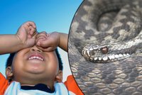 Chlapečka (3) uštkla zmije: V nemocnici bojuje o život!