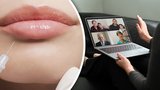 Experti upozorňují na daň za časté videokonference: I Češi se ženou na plastiky