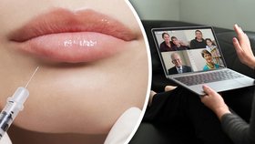 Experti upozorňují na daň za časté videokonference: I Češi se ženou na plastiky