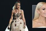 Zpěvačka Gwen Stefaniová to přehnala s botoxem!