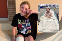 Dívku (12) u pláže napadl žralok: Třikrát se jí zakousl do nohy!