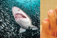 Útok žraloka v dovolenkovém ráji? Dívenku (11) ve vodě něco děsivě pokousalo
