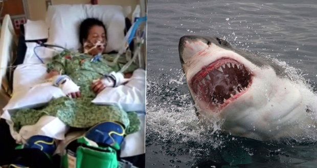 Žralok ukousl ženě kus nohy: Zkoušela mu vydloubat oči, aby přežila