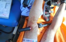  Hrozivé zranění jen pro otrlé: Cyklistovi nohu probodla řidítka!