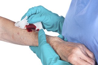 Jak správně ošetřit krvácivé rány?