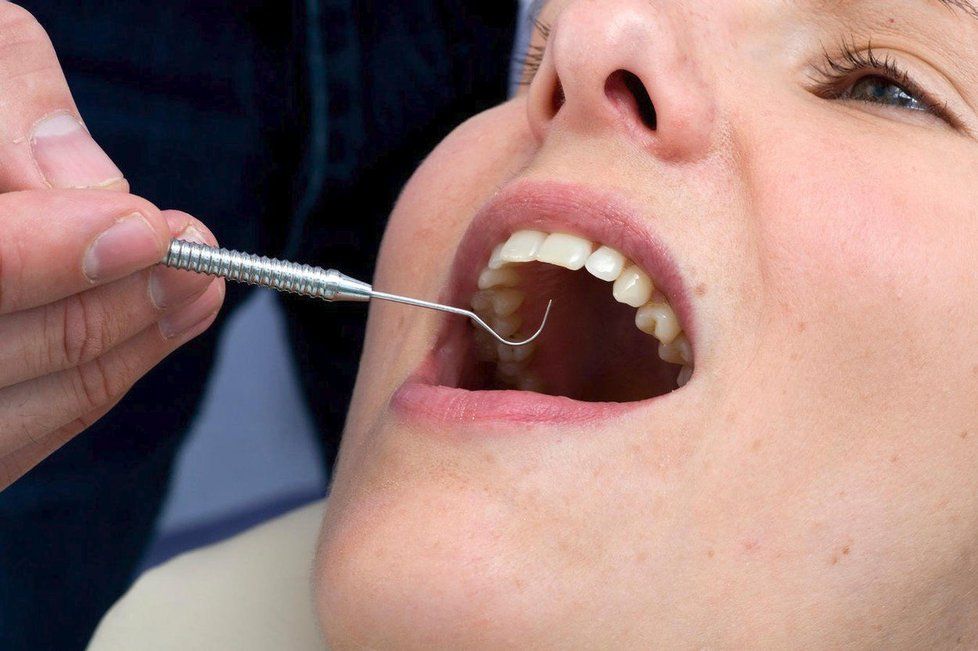 Česko má zubařů dostatek, koncentrují se však jen na určitých místech (ilustrační foto)
