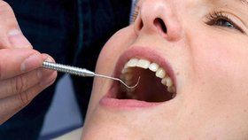 Bruntál spouští registraci u nového zubaře: Místo pro 1500 šťastlivců