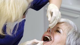 Nepodceňujte ústní hygienu! Zkažené zuby mohou vést až k mrtvici či infarktu.