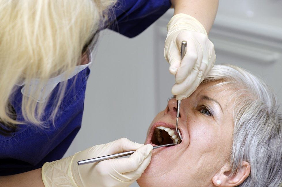 Česká stomatologická komora navrhuje, aby si lidé hradili zubní výplně zcela ze svého.