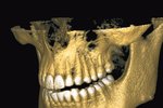 V Česku jsou 3D dentální počítačové tomografy, které umí takové obrázky udělat, novinkou.