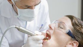 Česká stomatologická komora navrhuje, aby si lidé hradili zubní výplně zcela ze svého.