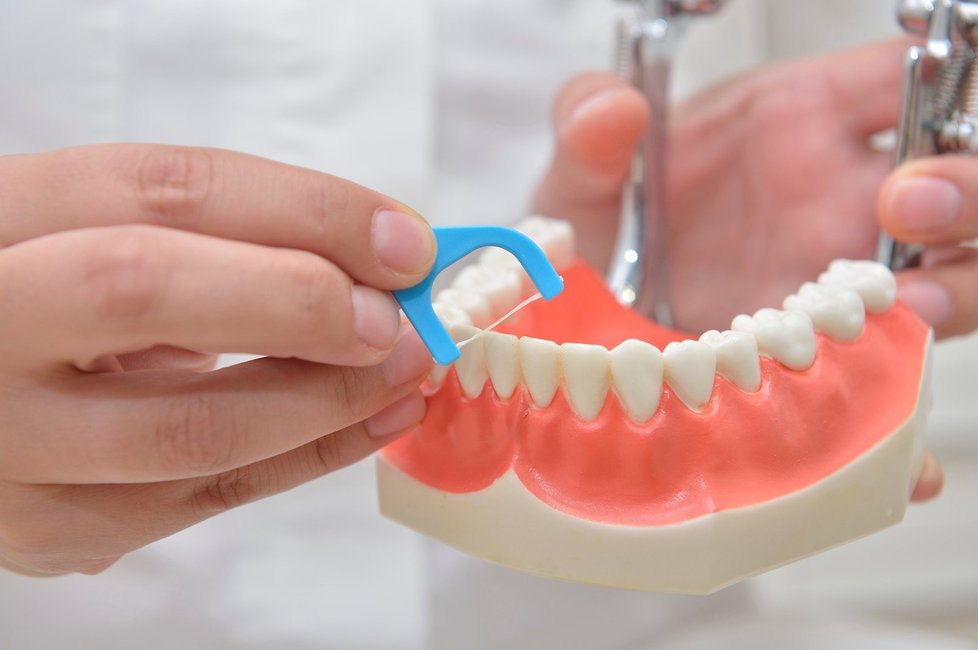 Zubní nit: Každý mezizubní prostor nití projedeme nadvakrát. Nití pohybujeme jemnými pohyby vzad i vpřed nejdřív u jedné a pak u druhé strany mezizubního prostoru.