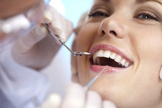 Zubní implantáty: Průvodce operací krok za krokem