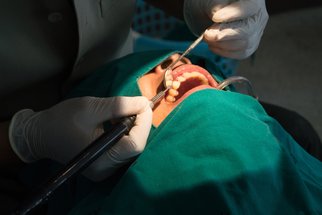 Pacient a právo: Zubní implantáty „na pojišťovnu“ 