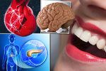 Bolest zubů vypovídá o stavu našich vnitřních orgánů.