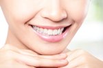 Efektivní bělení zubů gelem bez obsahu peroxidu mohou absolvovat i osoby s citlivými zuby, odhalenými krčky, paradentózou, přítomností zubních kazů, prasklin skloviny či jiných defektů, onemocněním dásní a i těhotné či kojící osoby.